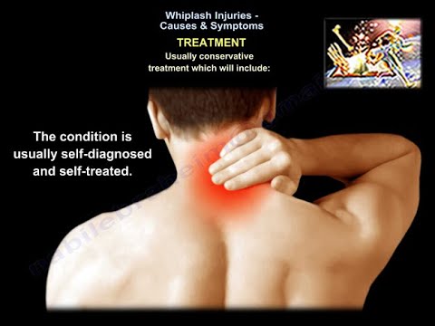 Whiplash Injuries Causes & Symptoms - Everything You Need To Know - Dr. Nabil Ebraheim